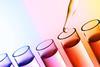 Top of test tubes containing liquid with pipette releasing a drop of liquid into one